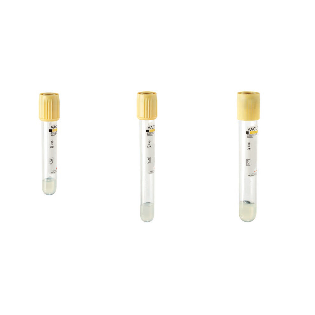 Gel and clot activator tubes