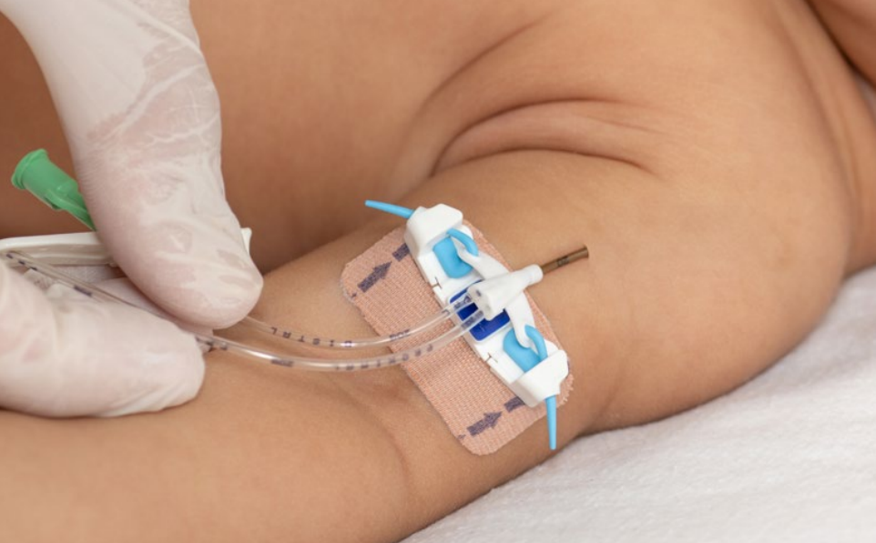 FlexGrip® Neonatale katheterfixatie-devices